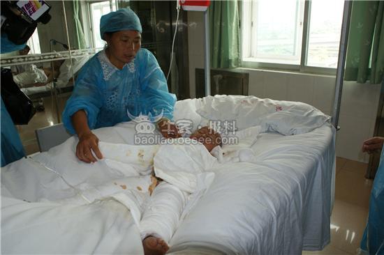 [疏忽]两小孩抢玩具 不慎掉入滚开油锅