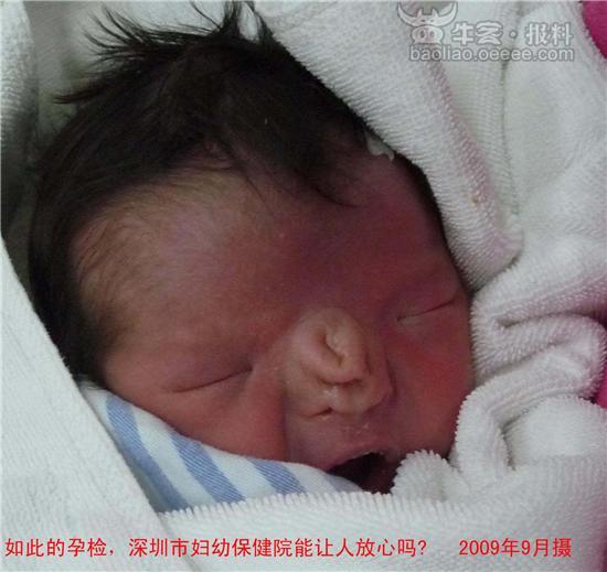 市妇幼<em>保健院</em>能让人放心吗