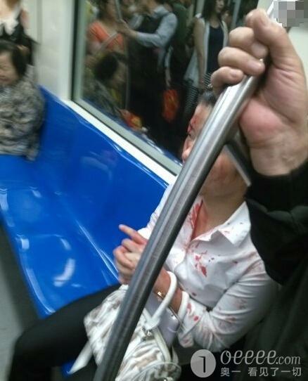 地铁拥挤 女子脱高跟鞋砸破男子头