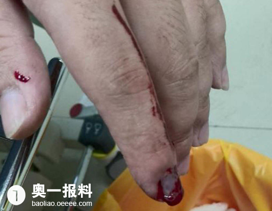 水很深!深圳东门大厦建筑工被神秘铁棍团猛击