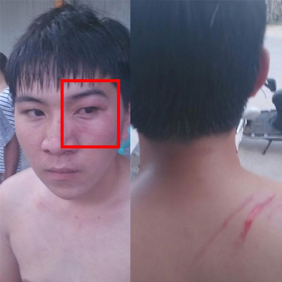 惠来县歧石镇览表村村党支部书记吴永乐涉嫌多项严重犯罪