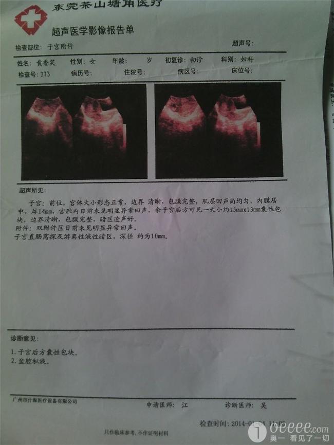 盆腔炎B超图片图片