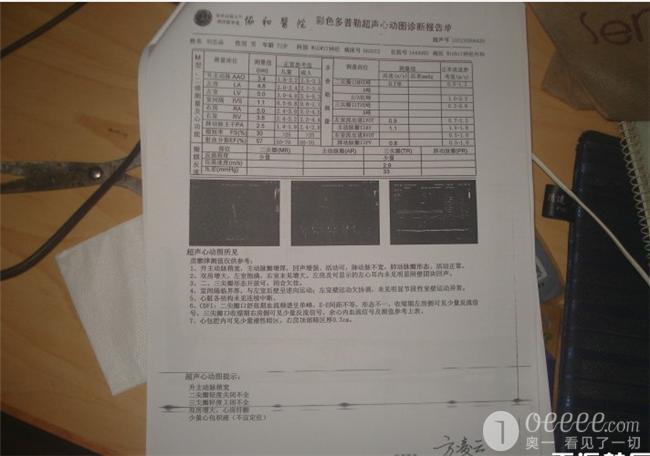 心梗检查报告图片图片