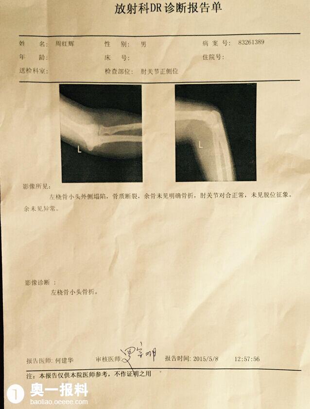 打到骨折,推卸責任不說,拖延時間篡改病歷,他們不僅不給我們說法還打