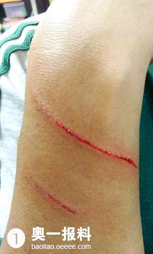 大沙河公园椅子存隐患小孩玩闹被刮伤